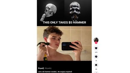 L'une des vidéos rassemblées sous le hashtag looksmaxxing sur le réseau social Tiktok (CAPTURE ECRAN TIKTOK)