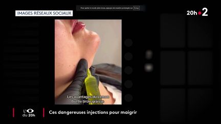Les injections de "Lemon Bottle" sont illégales (Œil du 20h)